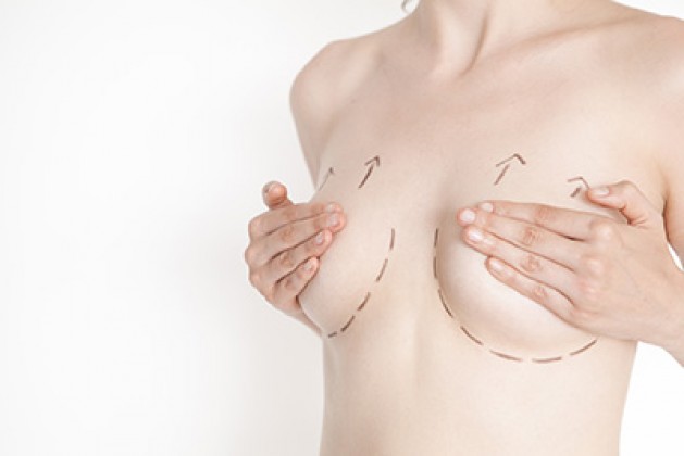 Breast reconstruction