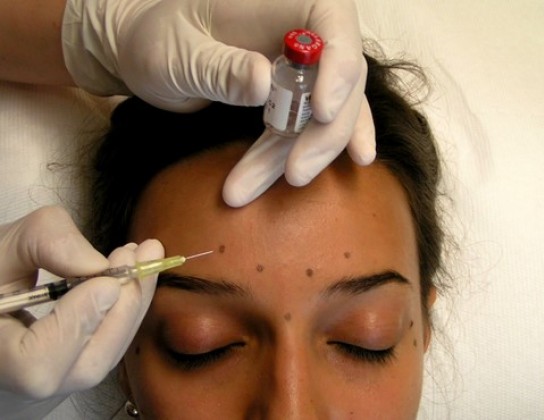 Injections Botox pour le visage Le Mans | Dr J.L. Durand