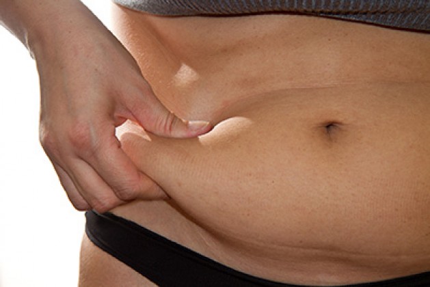 La liposuccion du ventre Le Mans | Dr J.L. Durand, chirurgie esthétique